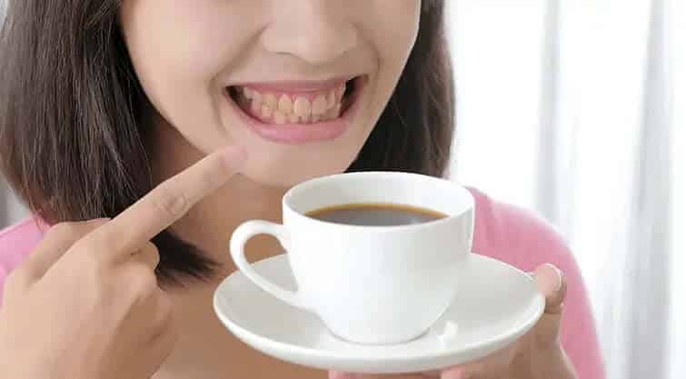 Woman pointing to stained teeth while holding a cup of coffee, showing effects of coffee stains before whitening