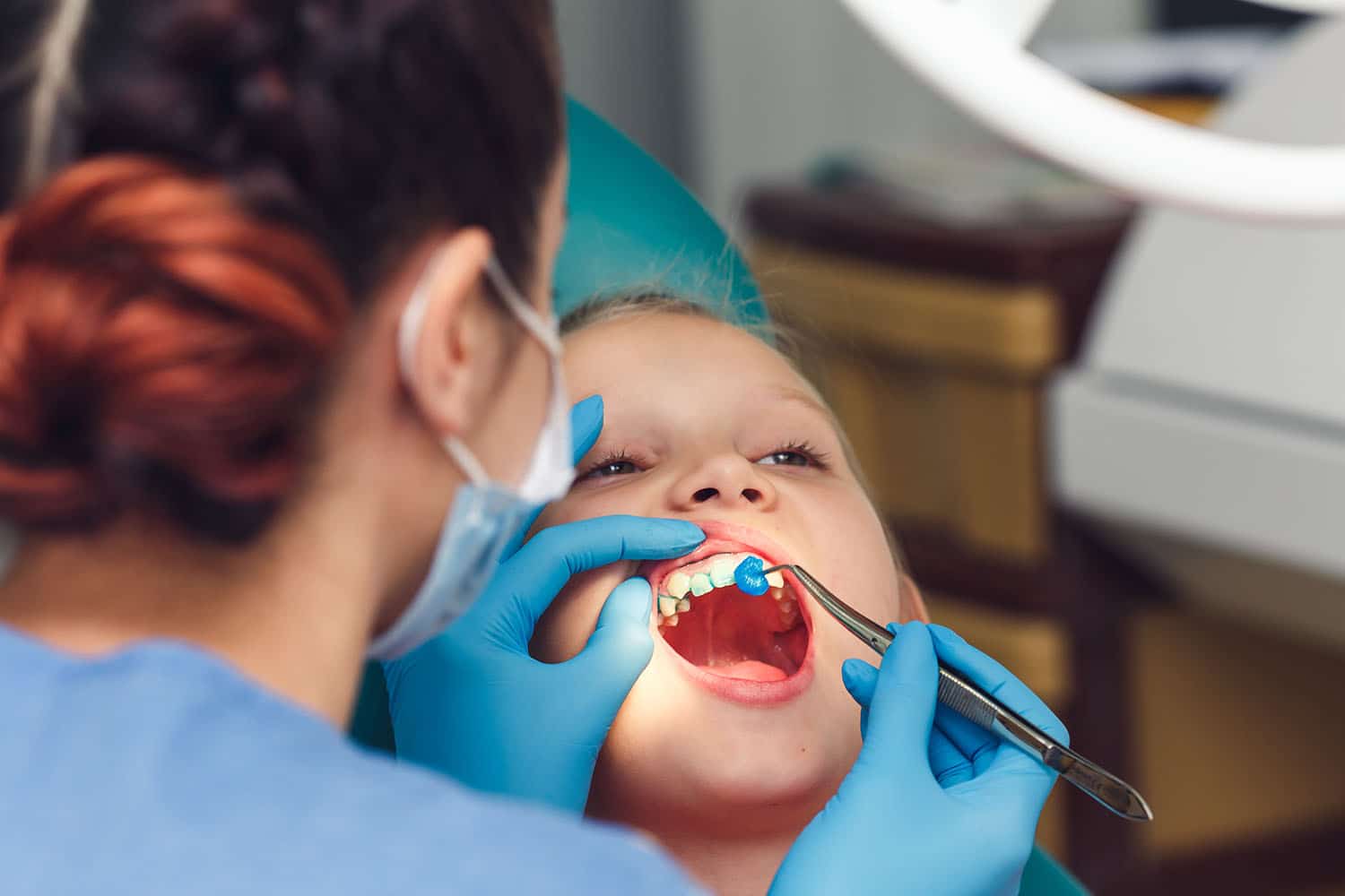 Child receiving fluoride treatment while a dental professional applies gel to teeth