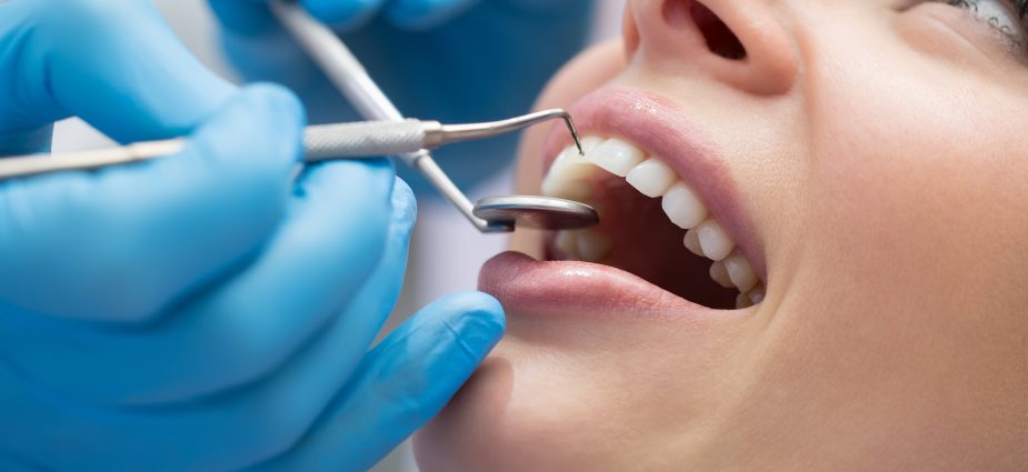 Close-up of dentist using dental tools to examine teeth for cracks and signs of tooth damage