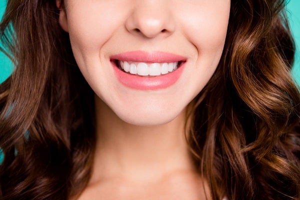 Close-up of a woman smiling with smooth white front teeth after cosmetic bonding treatment.